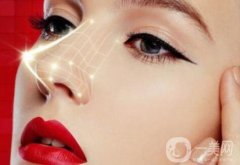 做自体隆鼻调节果怎么样?果保持时间多久?