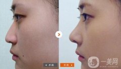 做垫鼻基底调节果怎么样?果保持时间多久?