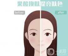 果酸换肤的果可以维持多久？有哪些症状适用于果酸换肤？