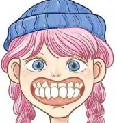 地包天是怎么形成的?地包天怎么矫正?