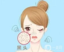 果酸换肤去黑头的果怎么样呢？有哪些医美项目可以改良黑头？