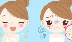 激光祛斑后结痂脱落需要多少天？激光祛斑后可以洗脸吗？