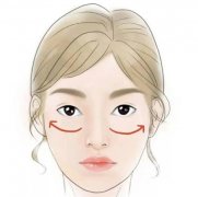 韩国婕尔玻尿酸怎么样?注射婕尔玻尿酸可以维持多久?