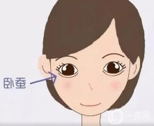 自体脂肪和玻尿酸可以填充卧蚕吗？卧蚕手术有哪些副作用