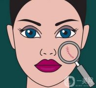 调节手术疤痕有什么好方法？