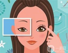 疤痕体质能割双眼皮吗？哪些人不适合切开双眼皮？