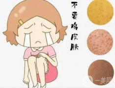 激光可以去除鸡皮吗？鸡皮去除有哪些注意事项