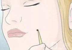 激光点痣后的凹洞如何护理？激光点痣后要忌口多久？