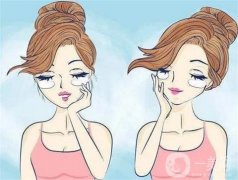 什么因素影响去除眼袋的价格？去眼袋的误区有哪些？