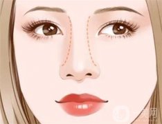 什么是？包含了什么？