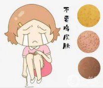 鸡皮可以用激光去除吗？具体有哪些注意事项呢？