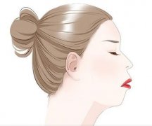 骨性嘴凸一般有哪些特征？骨性嘴凸怎么办？