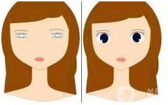 关于三点定位双眼皮体验是怎么样的？来你看看