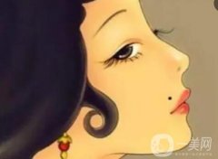 冰冻点痣与激光点痣的优缺点？