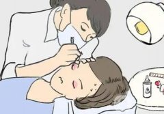 做美瞳线需要麻醉吗？应该怎么涂麻药？