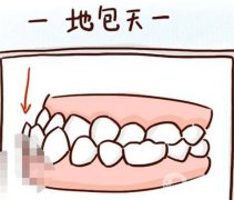 地包天调节方法有哪些？注意事项？