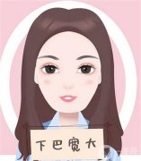 垫下巴多久可以侧睡？恢复期是多久？