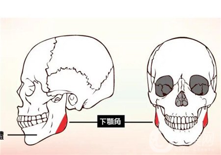 磨骨手术照片 磨骨*果怎么样？