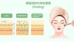 果酸换肤后怎么保养避免复发