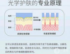 光子嫩肤性怎么样？