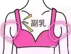 切除副乳后有哪些注意事项？