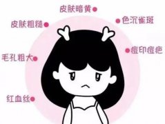 什么是果酸换肤？有哪些优势和劣势？