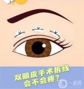 双眼皮什么时候做好？双眼皮适合秋天做吗?