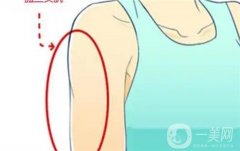 威塑抽脂等于减肥?抽脂会复胖吗?