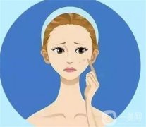 黄褐斑可以用去除吗？蜂巢的工作原理是什么？