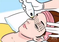 热玛吉有什么优势？会导致皮肤损伤吗？