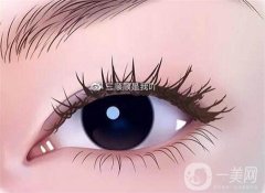 不适合开眼角的人群？不适合开眼角的人群有哪些？