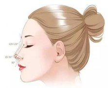 矫正鹰钩鼻吗?哪里矫正鹰钩鼻比较好?