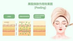 果酸换肤有哪些适用范围？适合哪些人？
