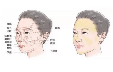 上海伯思立徐文龙主任鼻部手术案例一则，照及经验分享