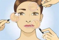 热玛吉果好吗？哪些人不适合做？