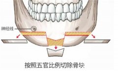 颧骨磨骨失败有哪些表现？有什么方法可以改良颧骨突出