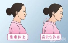 富贵包有什么危害和影响？