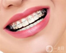 夏季暑期为什么是牙齿矫正的好时期?