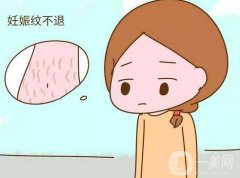 电波拉皮可以去除妊娠纹吗？果好不好