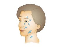 除皱手术的价格是多少？哪些人适合做面部除皱