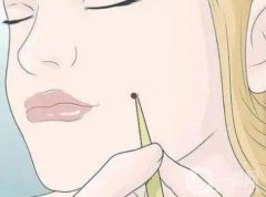 激光点痣后哪些食物需要忌口？