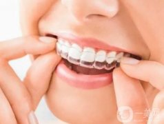 正雅隐形矫正器有哪些优点?