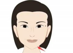 垫下巴前后的注意事项和后遗症？