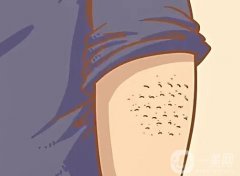 鸡皮的危害有哪些？激光可以去除鸡皮吗？