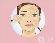 电波拉皮有哪些作用？需要几次？