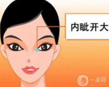 开眼角的增生会不会消失？