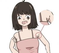 副乳切除后会不会影响淋巴？