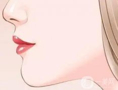 不同垫下巴的材料有什么不同？