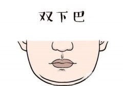 双下巴吸脂的原理是什么？果能长久保持吗？