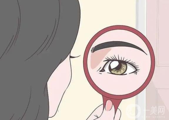 眼*整形全过程跟踪及术后恢复日记